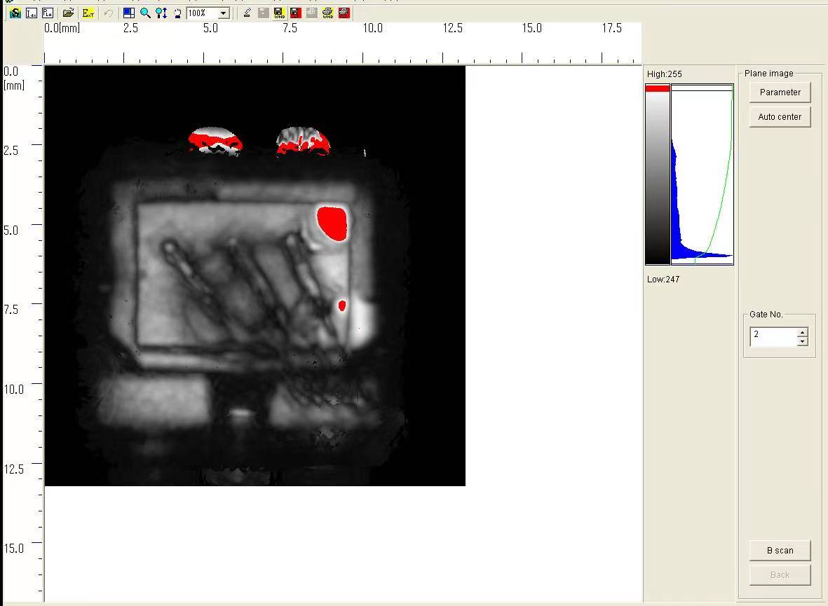 世纪远景 | 日立FS200 超声波影像装置 世纪远景 | 日立FS200 超声波影像装置
