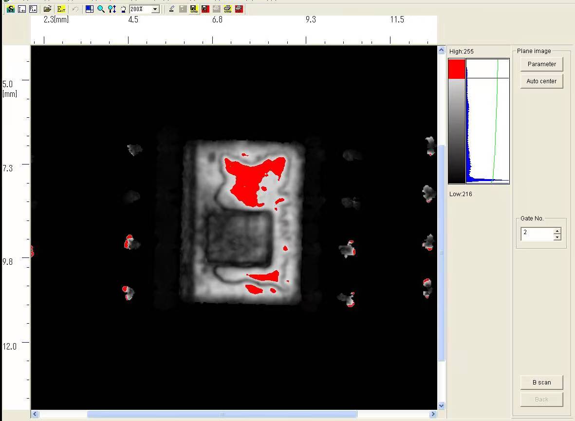 世纪远景 | 日立FS200 超声波影像装置 世纪远景 | 日立FS200 超声波影像装置